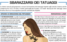 RIMOZIONE TATUAGGI